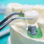 نتائج لقاء عطوفة النقيب مع امين عام المجلس الطبي الاردني بخصوص شهادات الاختصاص داخل الاردن قبل تاريخ 31/12/2005